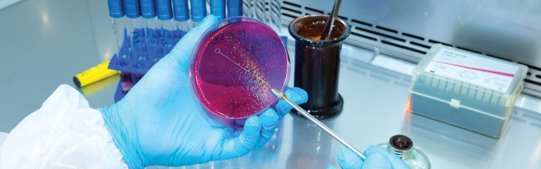 Bacteria culture test